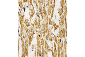 Immunohistochemical analysis of paraffin-embedded H. (FABP3 抗体  (AA 1-133))