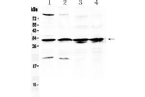 Western blot analysis of RPS6 using anti- RPS6 antibody . (RPS6 抗体  (N-Term))