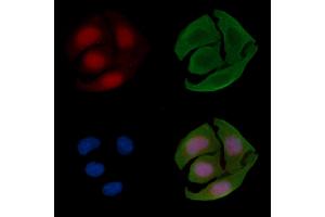 ABIN6264199 and ABIN6268876 staining Hela cells(30 min of UV treatment) by IF/ICC.