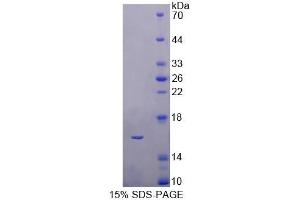 SDS-PAGE analysis of Human CBY1 Protein. (CBY1/PGEA1 蛋白)