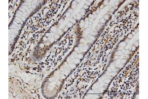 Immunostaining (ISt) image for anti-Family with Sequence Similarity 3, Member B (FAM3B) (AA 1-235) antibody (ABIN527010)