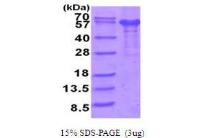 SDS-PAGE (SDS) image for Interleukin 12 Receptor beta 1 (IL12RB1) (AA 1-545) protein (His tag) (ABIN5854052) (IL12RB1 Protein (AA 1-545) (His tag))