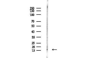 Western blot analysis of lysates from LoVo cells(heat-shock,45 min treatment), using RPS17 Antibody at 1/1000 dilution.