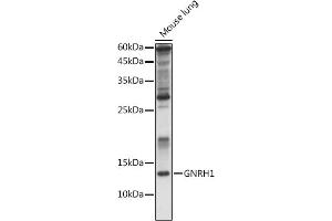 Western blot analysis of extracts of Rat kidney, using GNRH1 antibody (ABIN6131875, ABIN6141257, ABIN6141258 and ABIN6221260) at 1:1000 dilution. (GNRH1 抗体  (AA 24-92))