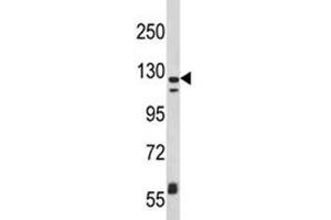 Western Blotting (WB) image for anti-Integrin, alpha X (Complement Component 3 Receptor 4 Subunit) (ITGAX) (AA 1119-1145) antibody (ABIN3031404)