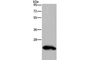 Western Blot analysis of Human placenta tissue using GH2 Polyclonal Antibody at dilution of 1:500 (Growth Hormone 2 抗体)