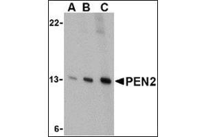 Western blot analysis of PEN2 in K562 cell lysate with this product at (A) 0. (PEN2 抗体  (C-Term))