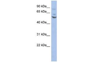 WB Suggested Anti-ETV1 Antibody Titration:  0.