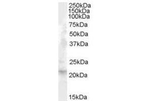 Image no. 1 for anti-Fibroblast Growth Factor 21 (FGF21) (Internal Region) antibody (ABIN374880) (FGF21 抗体  (Internal Region))