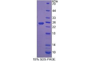 SDS-PAGE analysis of Rat RHAG Protein. (RHAG 蛋白)