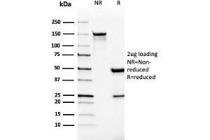 SDS-PAGE Analysis Purified Monospecific Mouse Monoclonal Antibody to VISTA (VISTA/2865). (VISTA 抗体)