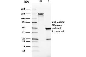 SDS-PAGE (SDS) image for anti-V-type immunoglobulin domain-containing suppressor of T-cell activation (VISTA) antibody (ABIN6940573)