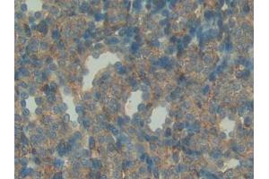 Detection of IGFBP7 in Rat Kidney Tissue using Polyclonal Antibody to Insulin Like Growth Factor Binding Protein 7 (IGFBP7) (IGFBP7 抗体  (AA 88-281))