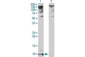 Western Blot analysis of CXCL5 expression in transfected 293T cell line by CXCL5 monoclonal antibody (M05), clone 2A9.