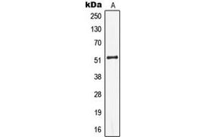 Western blot analysis of Cytokeratin 13 expression in Jurkat (A) whole cell lysates. (Cytokeratin 13 抗体  (Center))