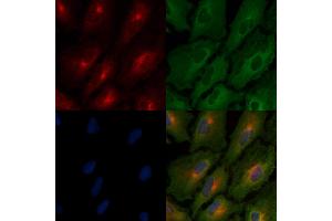 ABIN6264804 and ABIN6266494 staining  cells by IF/ICC. (MST1R 抗体  (C-Term))