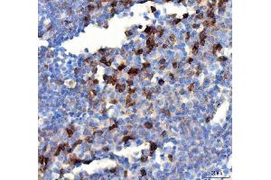IHC analysis of PDCD1 using anti PDCD1 antibody (ABIN5518784). (PD-1 抗体  (N-Term))