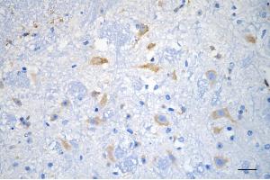anti-Leucine-Rich, Glioma Inactivated 1 (LGI1) antibody