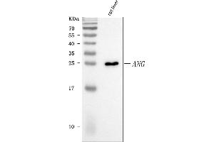 Western blot analysis of Angiogenin/Ang using anti-Angiogenin/Ang antibody (ABIN7600882).