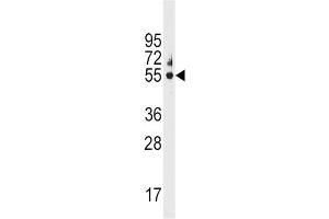 Western Blotting (WB) image for anti-Cytochrome P450, Family 3, Subfamily A, Polypeptide 5 (CYP3A5) antibody (ABIN3003497) (CYP3A5 抗体)