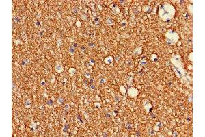 Immunohistochemistry of paraffin-embedded human brain tissue using ABIN7148931 at dilution of 1:100 (CDK5 抗体  (AA 1-292))