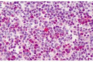 Human Tonsil: Formalin-Fixed, Paraffin-Embedded (FFPE) (BCL2L1 抗体  (C-Term))