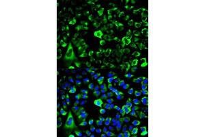 Immunofluorescence analysis of HeLa cells using RPS3 antibody. (RPS3 抗体  (AA 1-243))