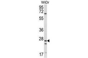 Western blot analysis of SCNN1A Antibody (Center) in WiDr cell line lysates (35ug/lane). (SCNN1A 抗体  (Middle Region))