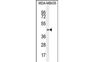 Western blot analysis in MDA-MB435 cell line lysates (35ug/lane). (OR2L13 抗体  (C-Term))