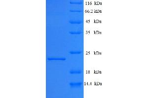 Interferon, kappa (IFNK) (AA 24-195) protein (His tag)
