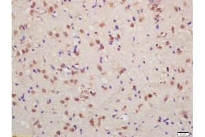 Formalin-fixed and paraffin embedded rat brain labeled with Anti-phospho-FMRP (Ser500) Polyclonal Antibody, Unconjugated (ABIN1714273) at 1:200 followed by conjugation to the secondary antibody and DAB staining (FMR1 抗体  (pSer500))
