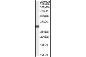 Image no. 1 for anti-Latexin (LXN) (C-Term) antibody (ABIN374848) (Latexin 抗体  (C-Term))