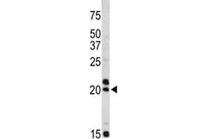 Western blot analysis of VIP antibody and Jurkat lysate. (Vip 抗体  (AA 139-167))