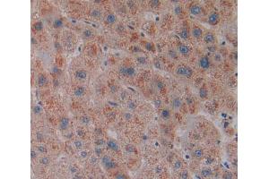 IHC-P analysis of Human Tissue, with DAB staining. (MGLL 抗体  (AA 1-303))