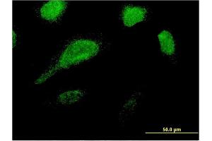 Immunofluorescence of monoclonal antibody to GLE1 on HeLa cell. (GLE1 抗体  (AA 140-240))