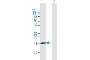 Western Blot analysis of TSEN15 expression in transfected 293T cell line by TSEN15 MaxPab polyclonal antibody. (TSEN15 抗体  (AA 1-171))