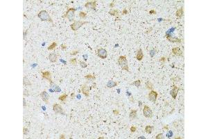 Immunohistochemistry of paraffin-embedded Rat brain using COG2 Polyclonal Antibody at dilution of 1:100 (40x lens). (COG2 抗体)