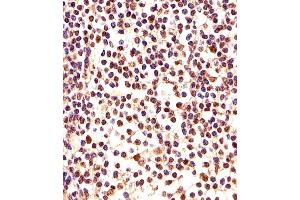 Immunohistochemical analysis of paraffin-embedded H. (PCNA 抗体  (C-Term))