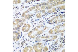 Immunohistochemistry of paraffin-embedded human stomach using EIF1AX antibody at dilution of 1:100 (40x lens). (EIF1AX 抗体)