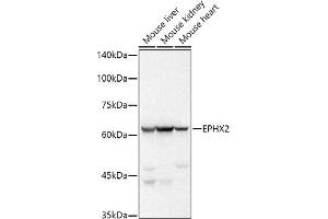 Western blot analysis of extracts of various cell lines, using EPHX2 antibody (ABIN7266999) at 1:500 dilution. (EPHX2 抗体)