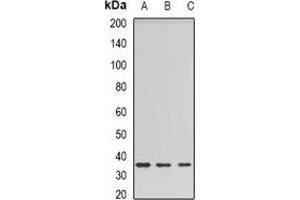 Western blot analysis of Barttin expression in HEK293T (A), rat liver (B), rat kidney (C) whole cell lysates. (BSND 抗体)