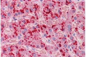 Human Liver: Formalin-Fixed, Paraffin-Embedded (FFPE) (APOA2 抗体  (AA 1-100))