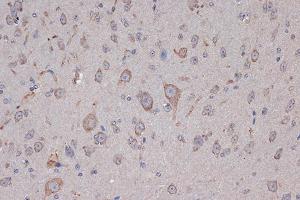 Immunohistochemistry of paraffin-embedded mouse brain using Xanthine Oxidase (XDH) (XDH) Rabbit mAb (ABIN7271408) at dilution of 1:100 (40x lens). (XDH 抗体)