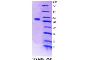 SDS-PAGE (SDS) image for Folylpolyglutamate Synthase (FPGS) (AA 210-439) protein (His tag) (ABIN6239110)