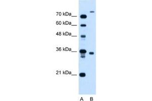 Western Blotting (WB) image for anti-FLJ22167 antibody (ABIN2464002) (FLJ22167 抗体)