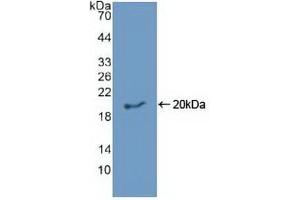 Detection of Recombinant EREG, Human using Polyclonal Antibody to Epiregulin (EREG) (Epiregulin 抗体)