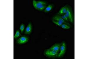 Immunofluorescent analysis of HepG2 cells using ABIN7159766 at dilution of 1:100 and Alexa Fluor 488-congugated AffiniPure Goat Anti-Rabbit IgG(H+L) (MAPRE2 抗体  (AA 159-240))
