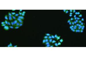 The image is immunofluorescence of HepG2 cell using VMA21 Polyclonal Antibody at dilution of 1:50. (VMA21 抗体)