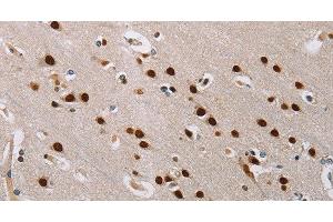 Immunohistochemistry of paraffin-embedded Human brain tissue using TONSL Polyclonal Antibody at dilution 1:60 (NFKBIL2 抗体)
