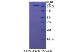 SDS-PAGE analysis of Cow HSPA1B Protein. (HSPA1B 蛋白)